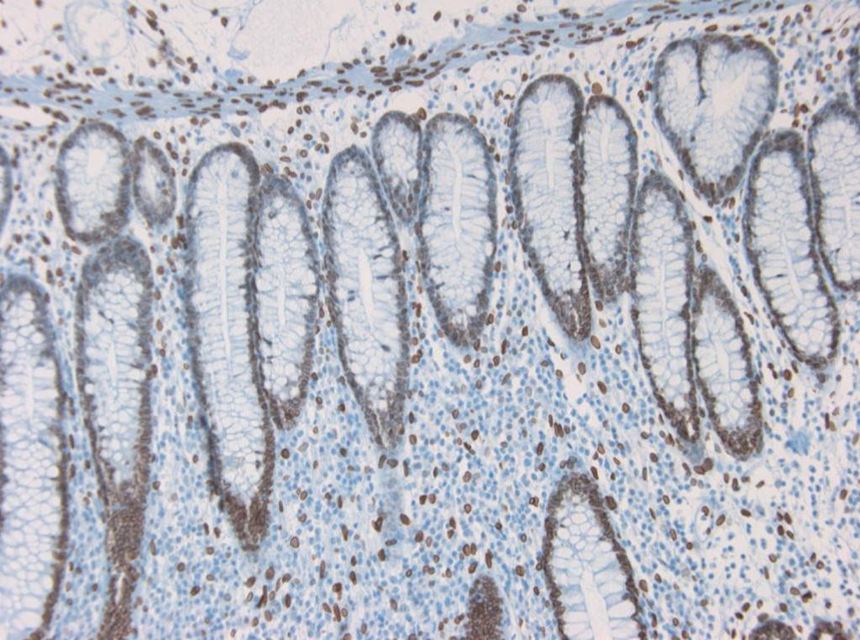  Figure 3 Immunohistochemistry on paraffin section of human colon